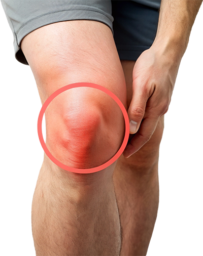 Total Knee Replacement Surgery